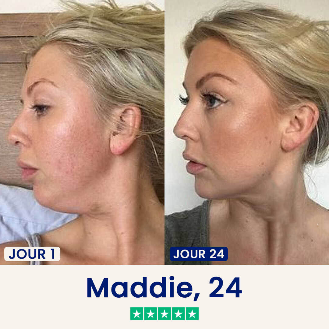 Le Masque Correcteur en 21 Jours