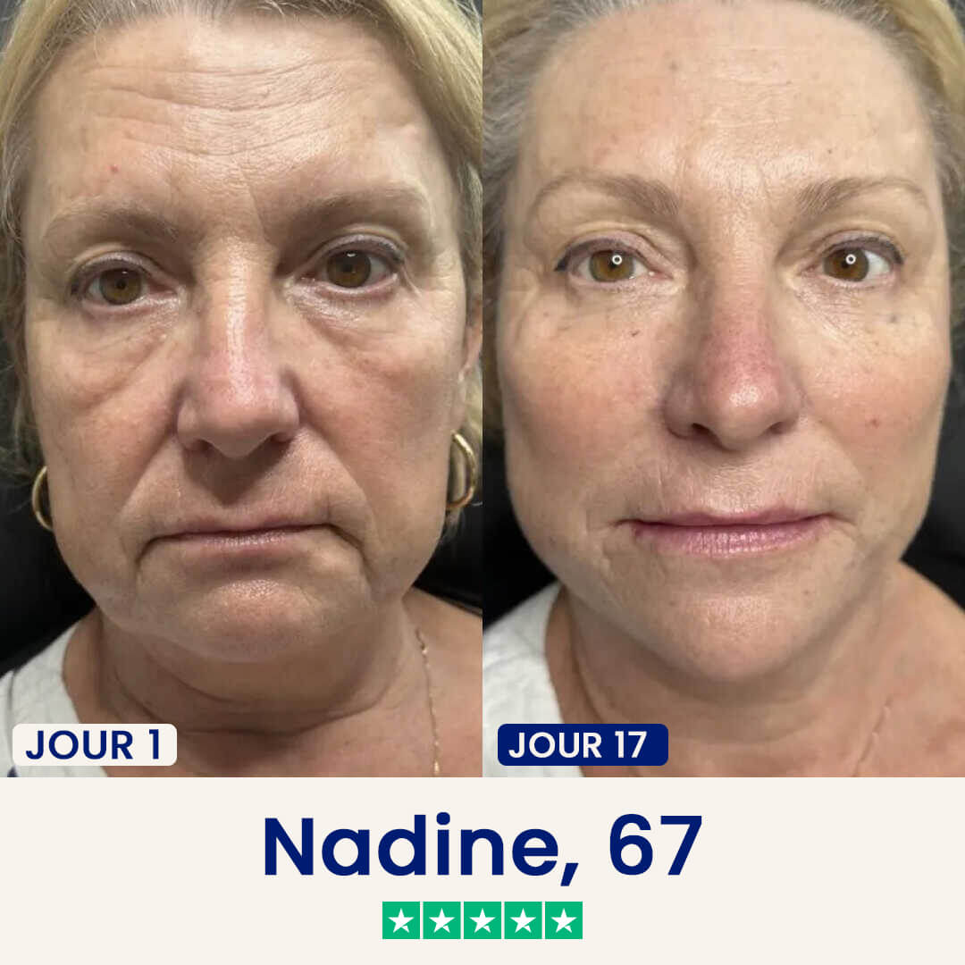 Le Masque Correcteur en 21 Jours