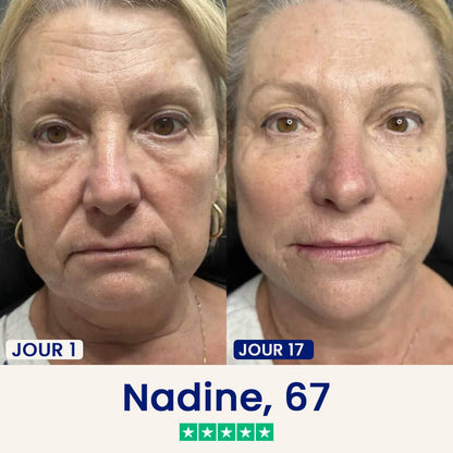 Le Masque Correcteur en 21 Jours