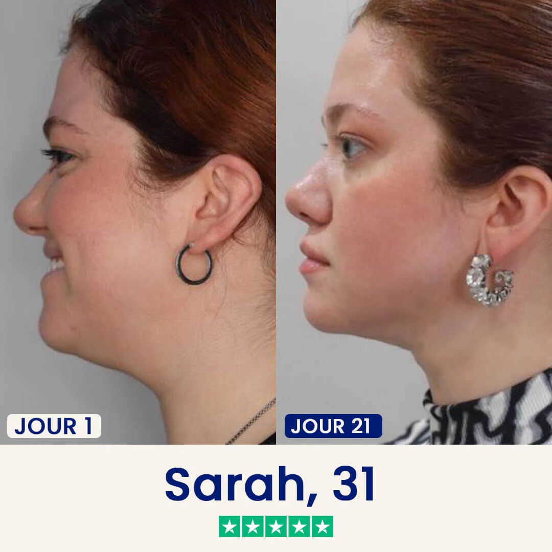 Le Masque Correcteur en 21 Jours