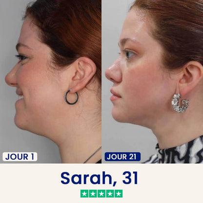 Le Masque Correcteur en 21 Jours